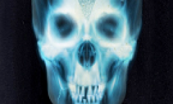 vignette head visceral